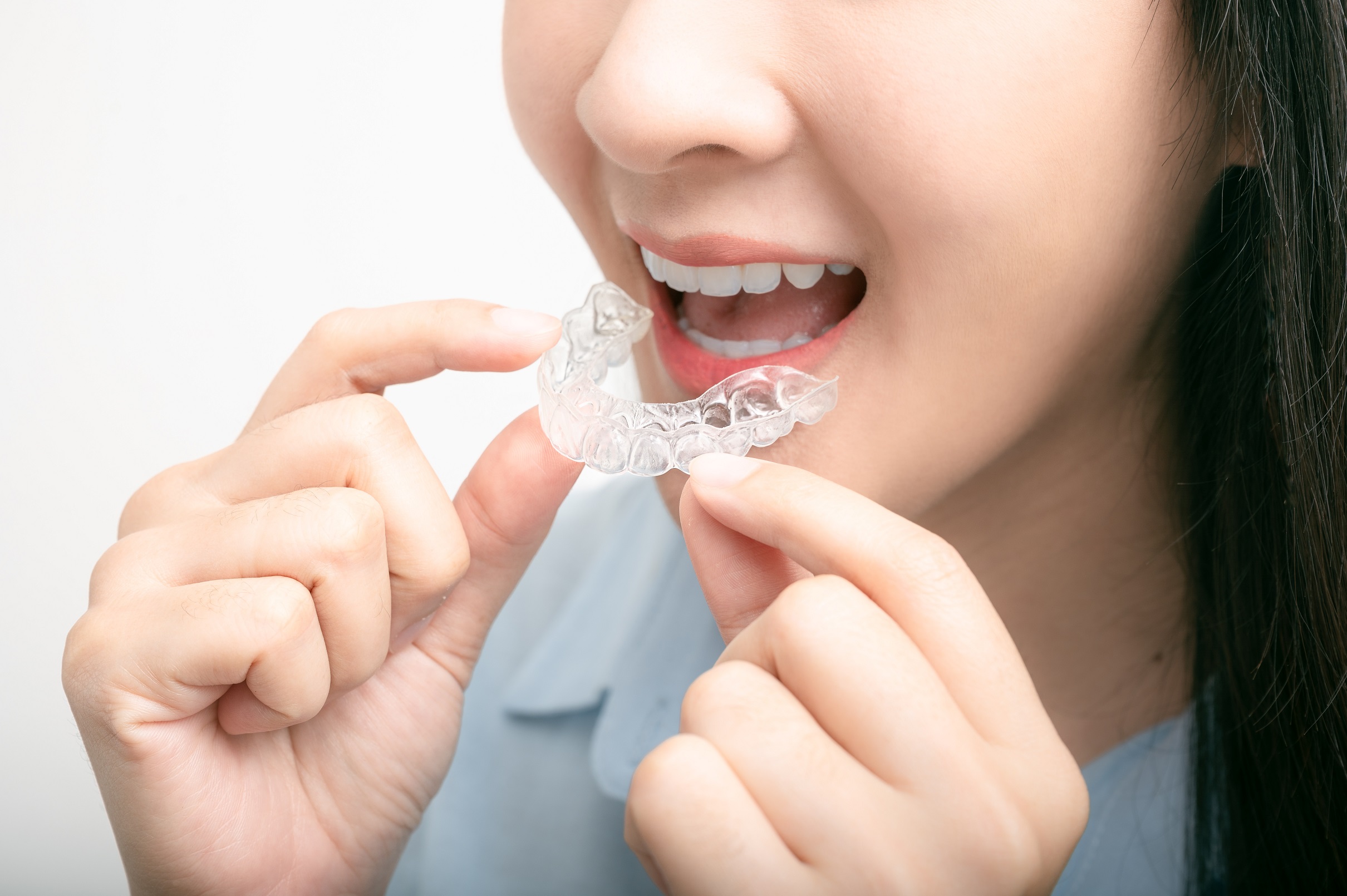 invisalign